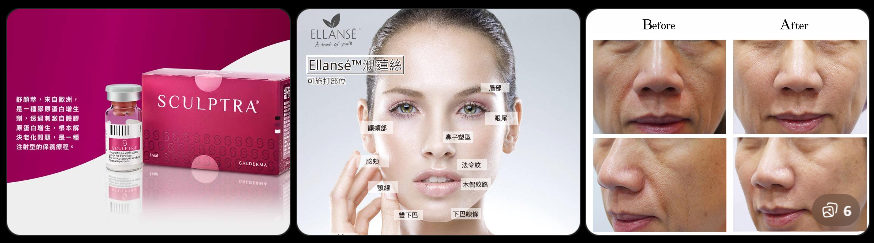胶原再生项目说明图